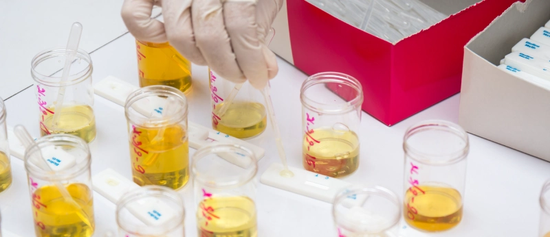 testing synthetic urines